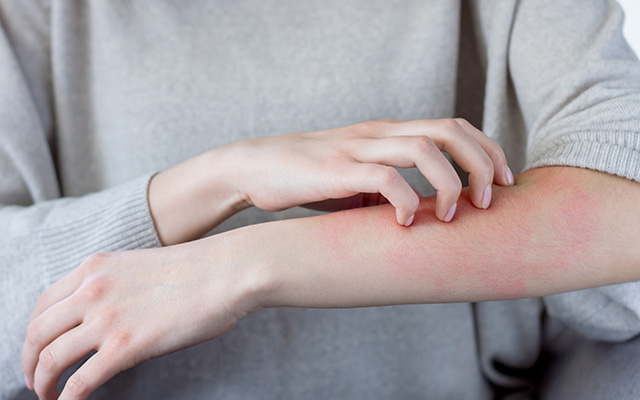 en som har helvetesild og kl&oslash;r p&aring; armen