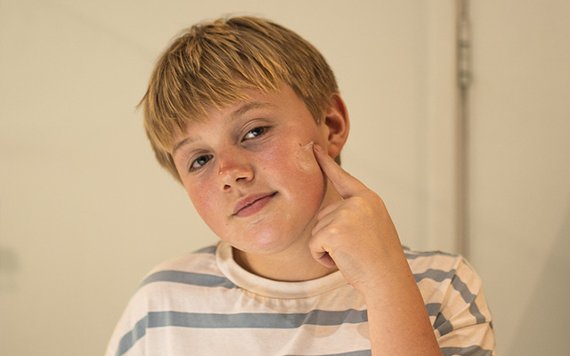 ten&aring;ring hudpleie