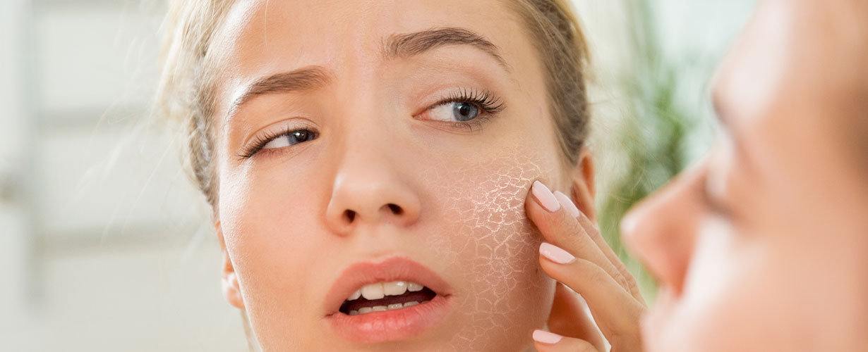 Tørr hud: Følelsen av tørr hud er ubehagelig. 