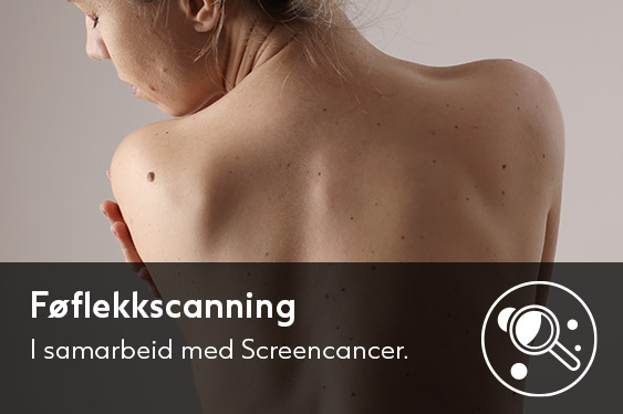 Føflekkskanning